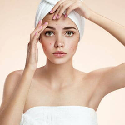 เซรั่มสิว Acne Serum ลดการอักเสบ ฟื้นฟูลดรอยดำ 3 เซรั่มสิว 1