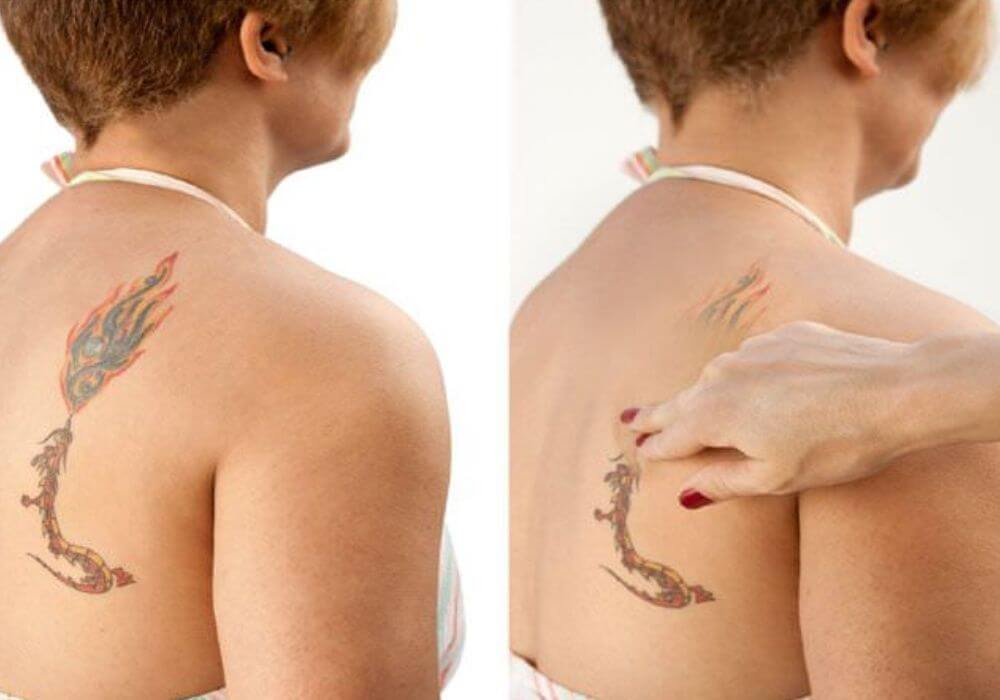 รองพื้นปิดรอยสัก Tattoo Cover Foundation หรือ Tattoo Concealer 2 รองพื้นปิดรอยสัก