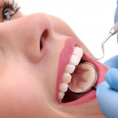 กระจกส่องฟัน Dental Mirror หรือ Mouth Mirror 3 กระจกส่องฟัน 1